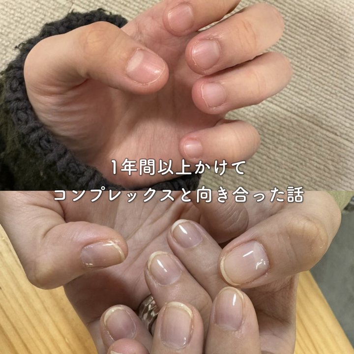 1年以上向き合った、爪のコンプレックスの話【FUDGENA SPECIALIST:kinokoのボーイズスタイル vol.174】